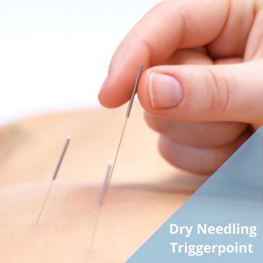 Dry Needling, triggerpoint